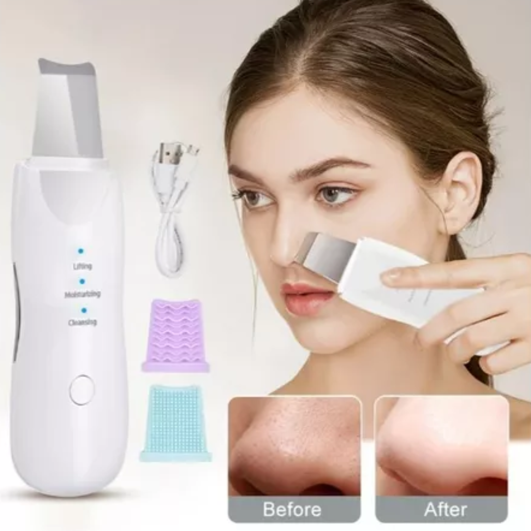 LIMPIADOR FACIAL ESPÁTULA ULTRASONIDO